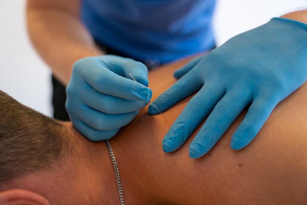 Dryneedling in Woerden